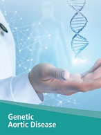 Genetic Aortic Disease