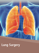 Lung Surgery
