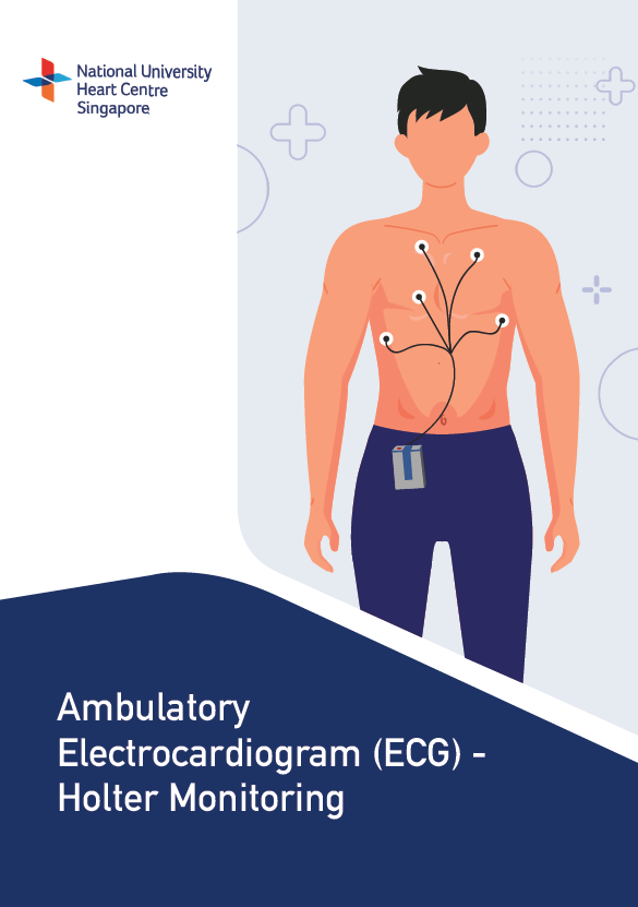 Ambulatory Electrocardiogram (ECG) - Holter Monitoring