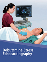 Dobutamine Stress Echocardiography