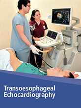 Transoesophageal Echocardiography 