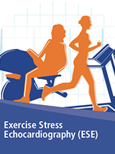 Exercise Stress Echocardiography 