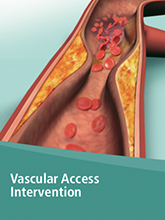 Vascular Access Intervention
