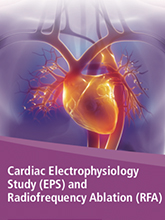 Cardiac Electrophysiology Study and Radiofrequency Ablation 