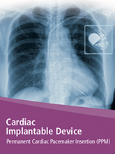 Permanent Cardiac Pacemaker Insertion