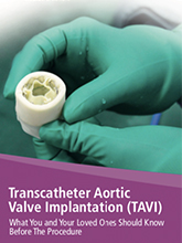 Transcatheter Aortic Valve Implantation 