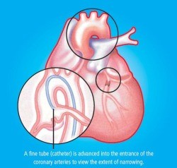 Heart Infographic