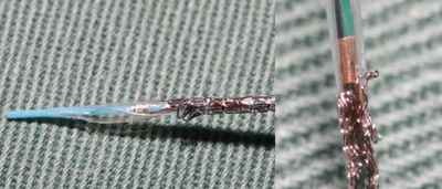 A sample of stent