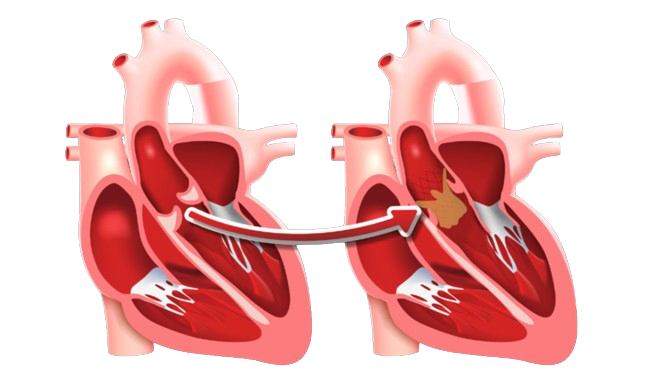 Heart Ilustration