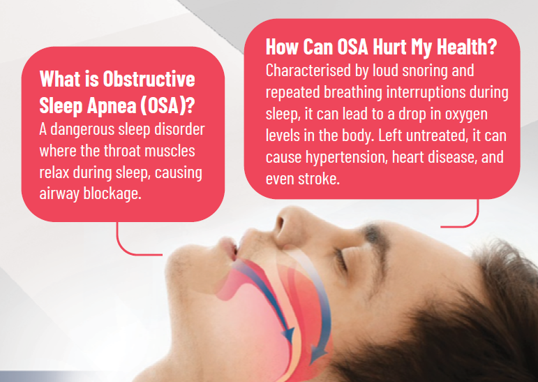 What is OSA inforgraphic